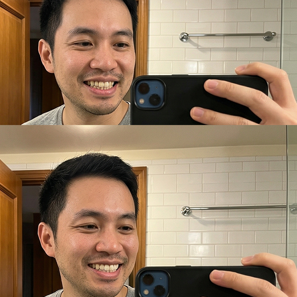 QuickWhiten: Purple Teeth Whitening Strips
