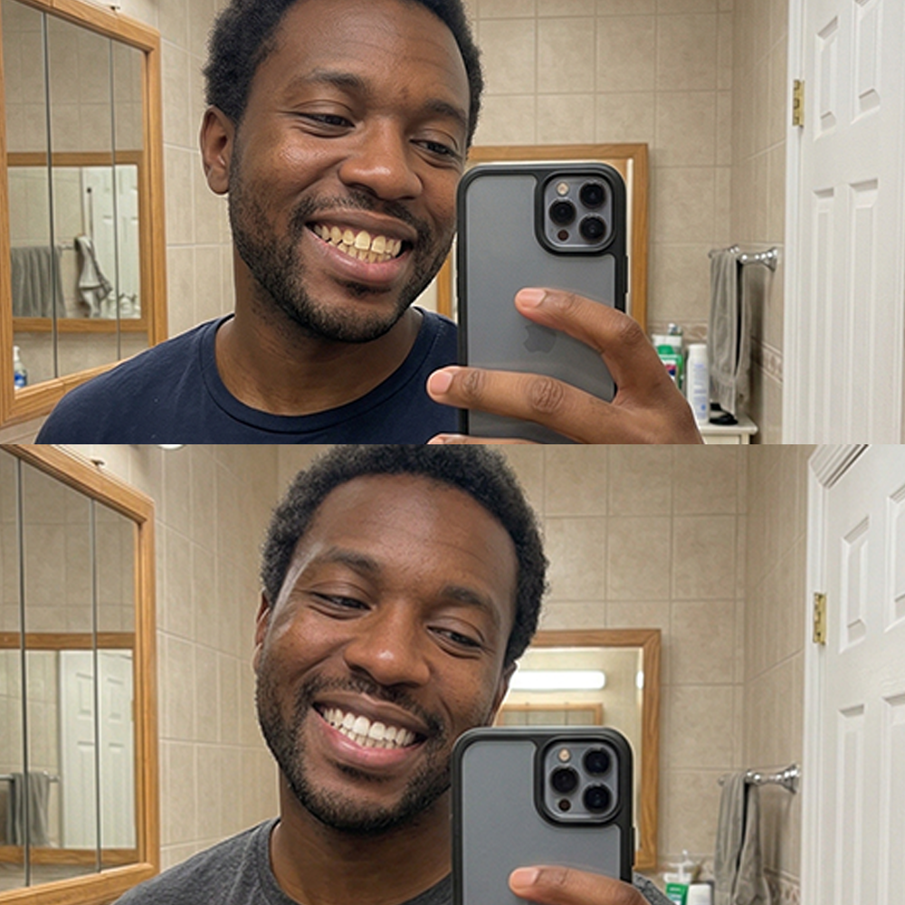 QuickWhiten: Purple Teeth Whitening Strips