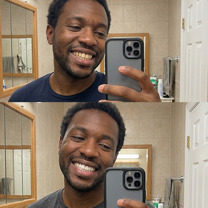 QuickWhiten: Purple Teeth Whitening Strips